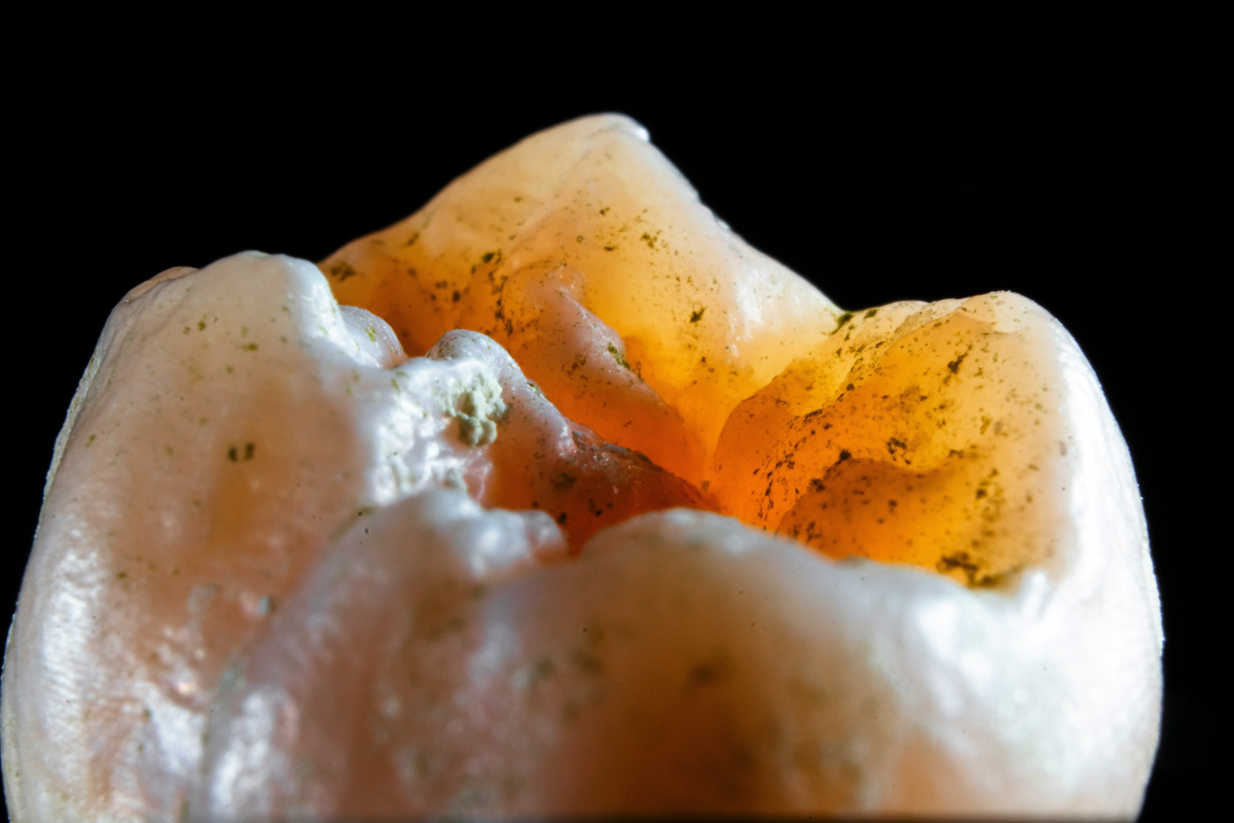 Emergency Exams & X-Rays